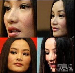 女明星有痘坑吗,痘坑问题与美丽挑战